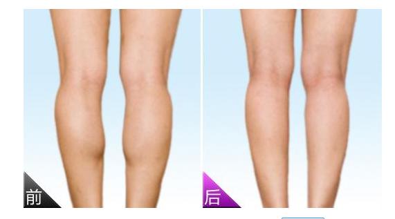 怎样瘦腿最快最有效最简单方法,运动瘦腿还是瘦腿神器瘦腿