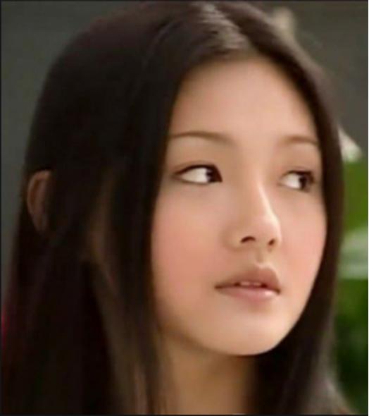 脸颊凹陷医美怎么改善,十全九美