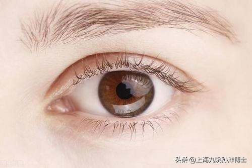 19岁全切双眼皮恢复图真实,眼修复手术