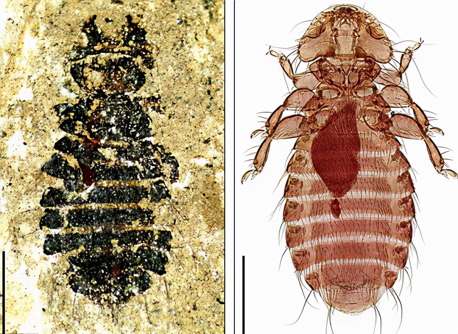 90年代虱子怎么就消失了,在头上喷洒敌敌畏治虱子的危害
