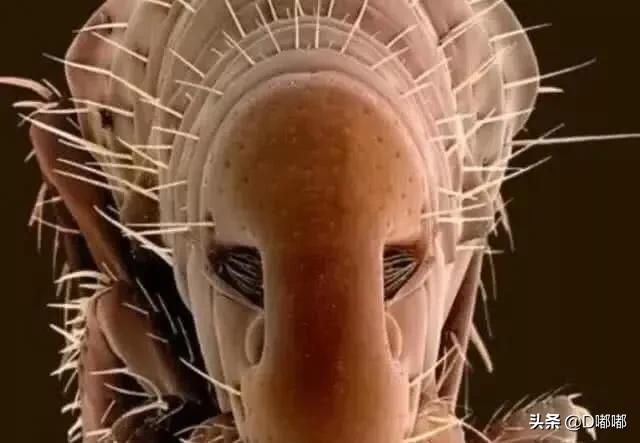 多少倍的显微镜可以看到寄生虫,15000倍显微镜下的螨虫危害