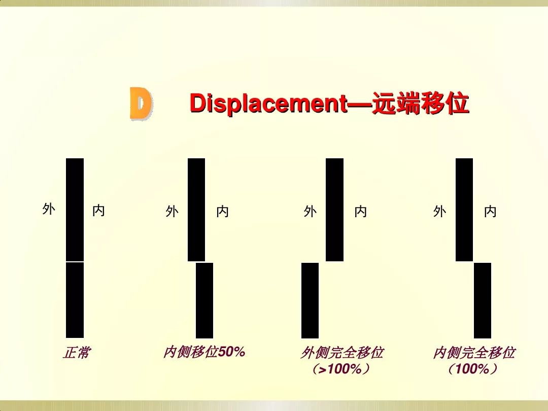 骨科x光片读片技巧,放射科骨科读片教程