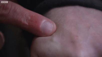 研制新冠疫苗过程视频教程,自制新冠病毒疫苗