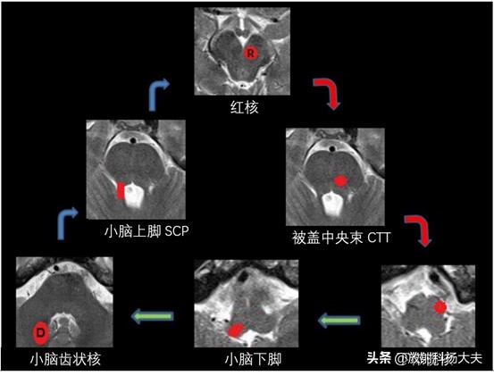 放射科趣味图片,放射科亮点图片