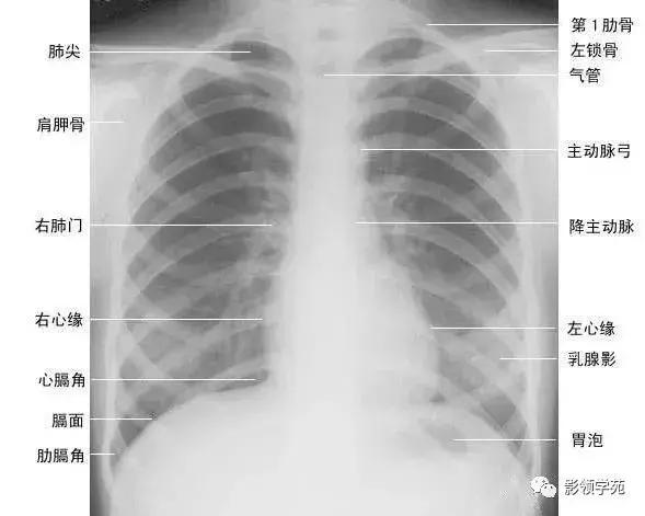 休闲小白鞋夏,献血小板相当于献血多少
