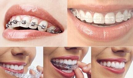 哈尔滨市儿童医院口腔科开展“世界正畸日”义诊周活动