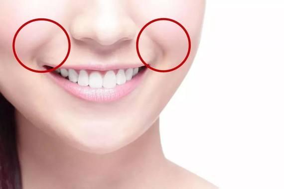 法令纹加深是什么情况？郑爽、杨紫都避免不了，如何去解决？