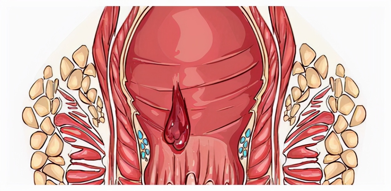 大便总有种拉不干净的感觉?其实是身体在告诉你这里可能出问题了