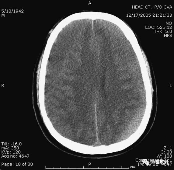 值夜班需要注意什么身体健康,值夜班的十大危害