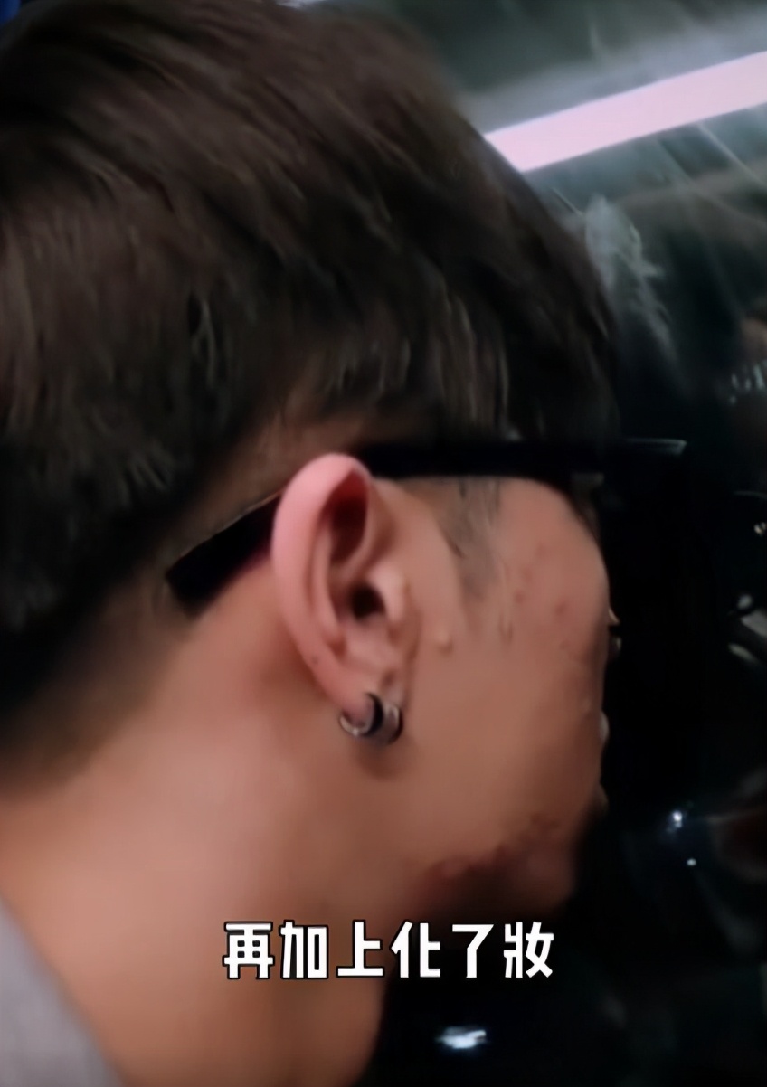 美妆网红晒华晨宇变脸过程质疑其做了3项整容手术，真的不怕被告