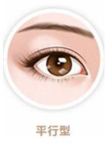 你适合哪种双眼皮类型,你适合哪种双眼皮