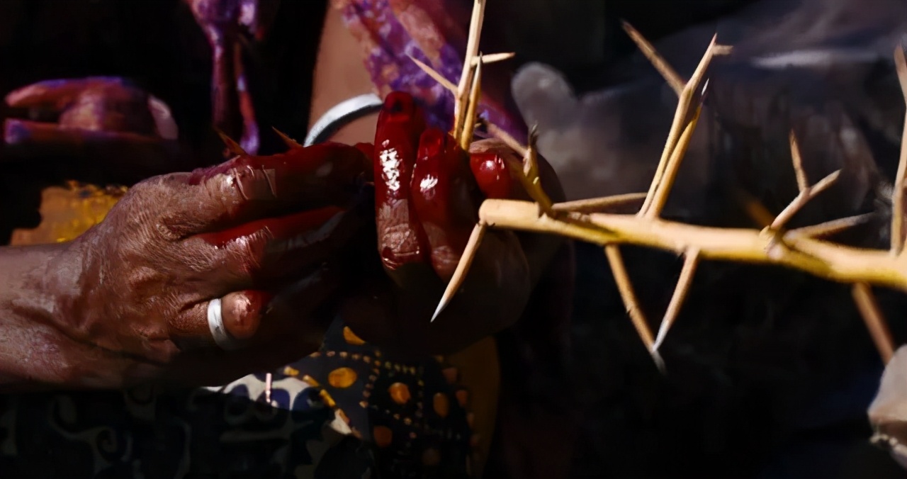 女子花50万整容被骗,女子花6万块整容被朋友毁容了