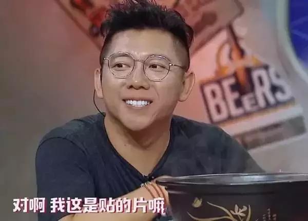 整牙一年半,这次重点说说整牙给我带来的小困扰