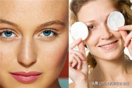 做拉皮手术会越来越老吗,拉皮手术适合的最大年龄