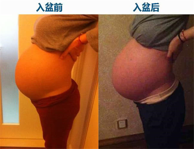 胎儿多大入盆有什么感觉,胎儿开始入盆到完全入盆要多久