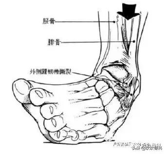骨科术前术后注意事项,骨科手术体位安置标准流程