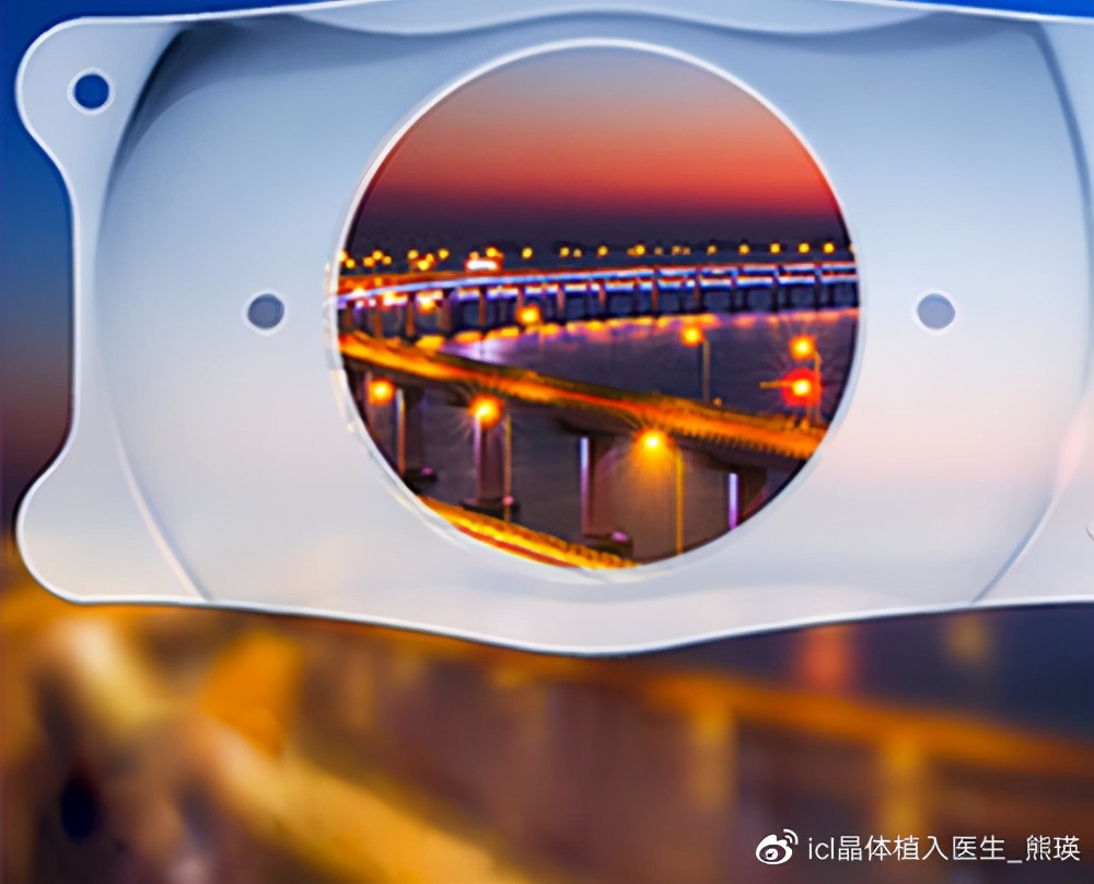 icl手术的后遗症,icl手术失败的案例