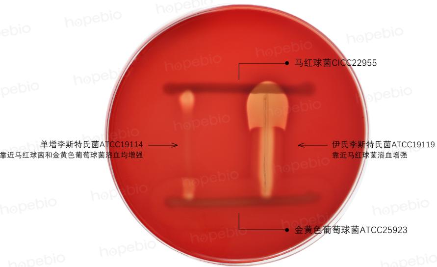 细菌溶血现象的原理,细菌革兰染色实验报告
