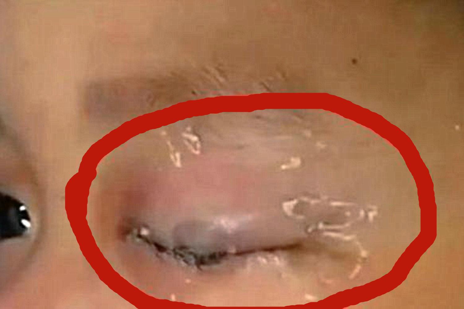 一岁半宝宝误食502胶，好在妈妈淡定处理，医生：妈妈机智