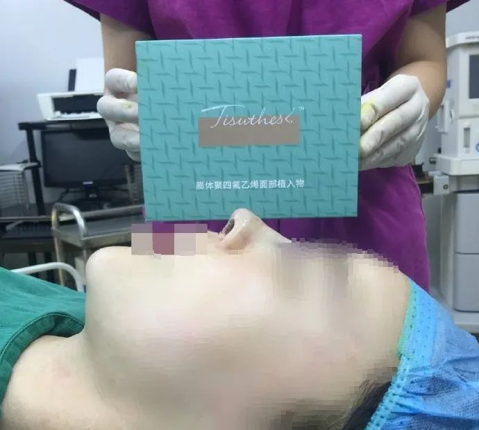 整形常见项目分布图,整形项目黄金搭配