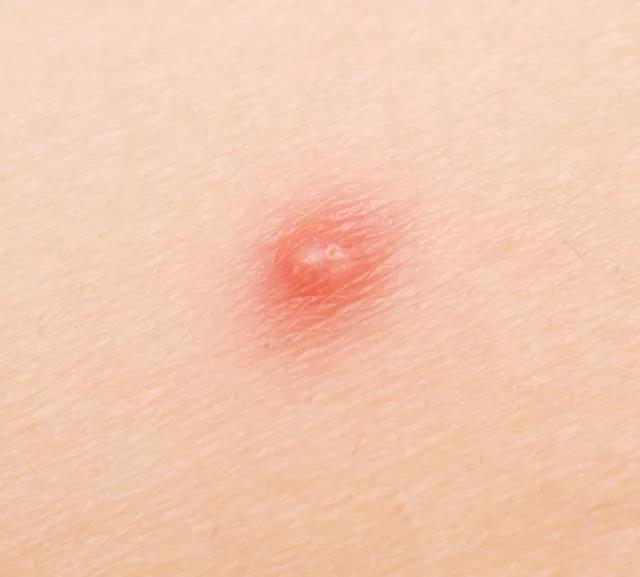 韩后神经酰胺补水保湿面膜,C5神经酰胺保湿修护面膜