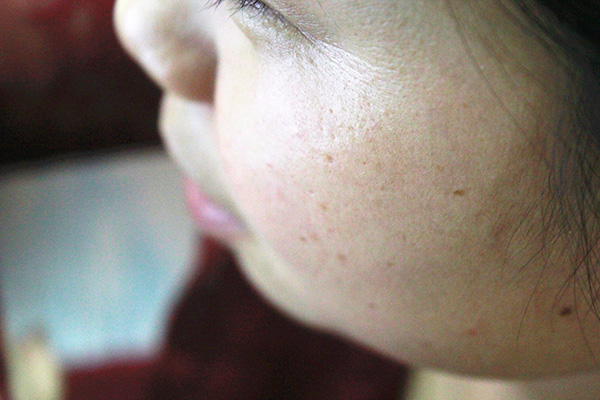 吃叶酸对40多岁的女人有什么好处,40多岁的女性怎样补充叶酸最合理