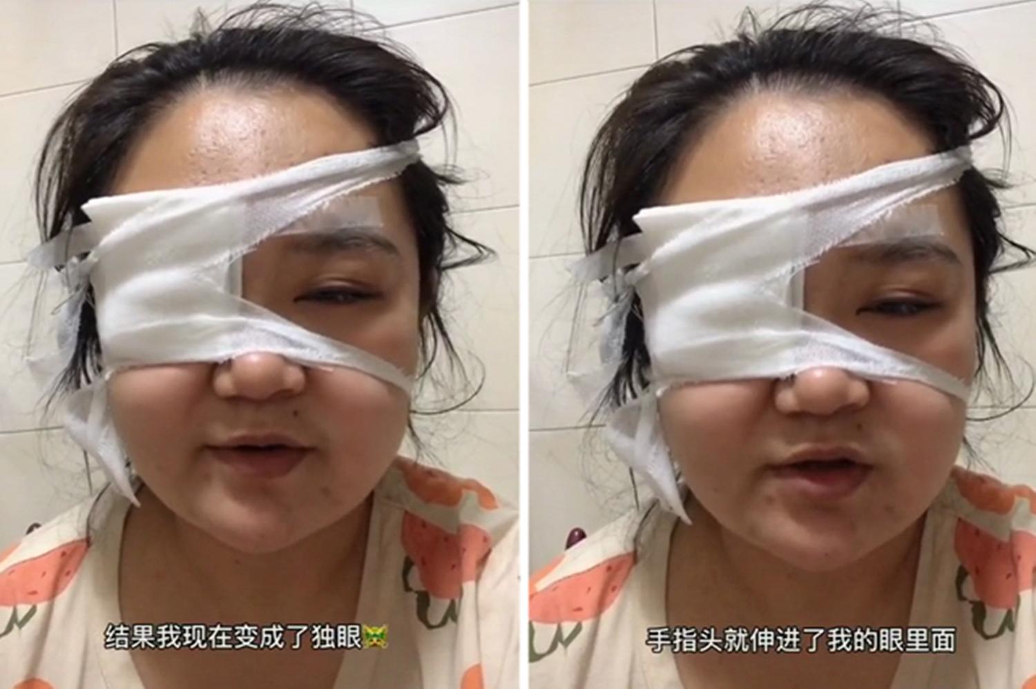 打嘴巴、扯头发、戳眼睛，为什么总是“攻击”妈妈？原因让人无奈