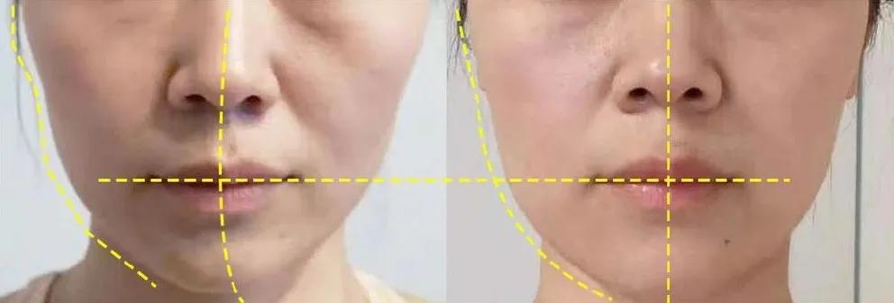 拯救颧骨高的教程,拯救脸大女生