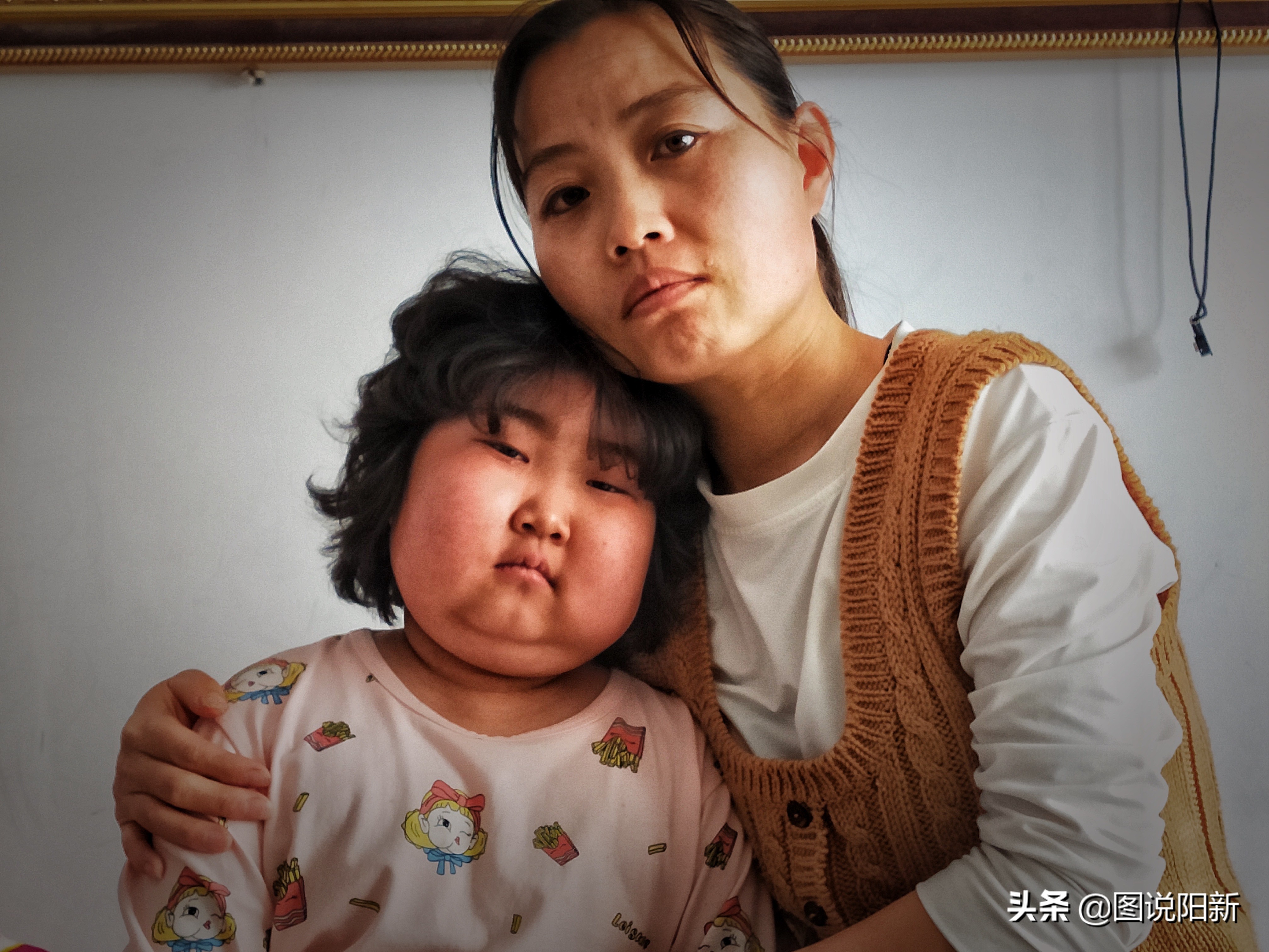 女孩患了200万分之一罕见病,女孩身患罕见怪病