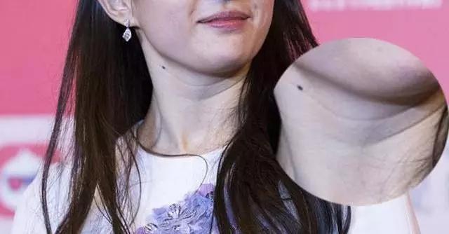 有颈纹和没有颈纹的女人,女人有颈纹怎么办