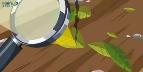 不开刀的子宫肌瘤消融术,不动手术做子宫肌瘤叫什么仪器