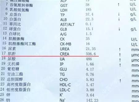 肌酐高对痛风有影响吗,疼痛会导致肌酐高