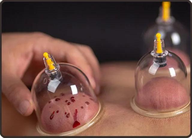 春季皮肤过敏吃什么抗过敏药,春季易过敏教你几个抗敏妙招