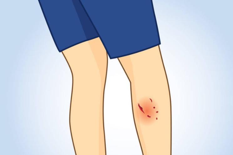 如何成功撤销治安处罚,行政拘留决定可以撤销吗