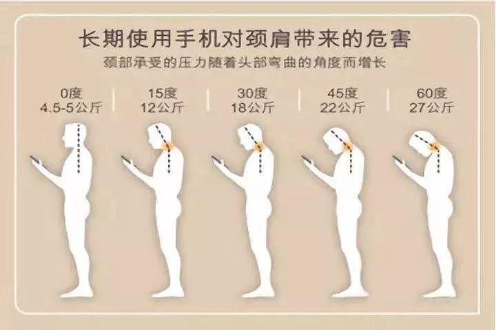 颈椎曲度康复案例,颈椎病康复科普文章图片