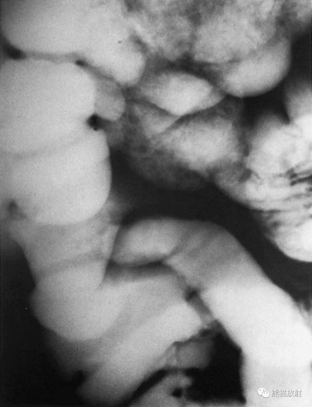 详细的消化道造影+彩色解剖图