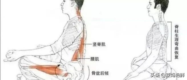 驼背不改正会越来越驼吗,为什么会驼背驼得很厉害