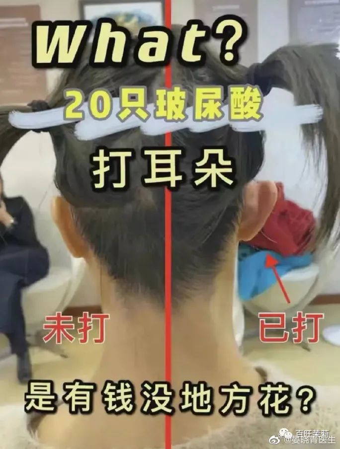 挑筋断骨切胃，那些为了美不要命的女人到底有多可怕