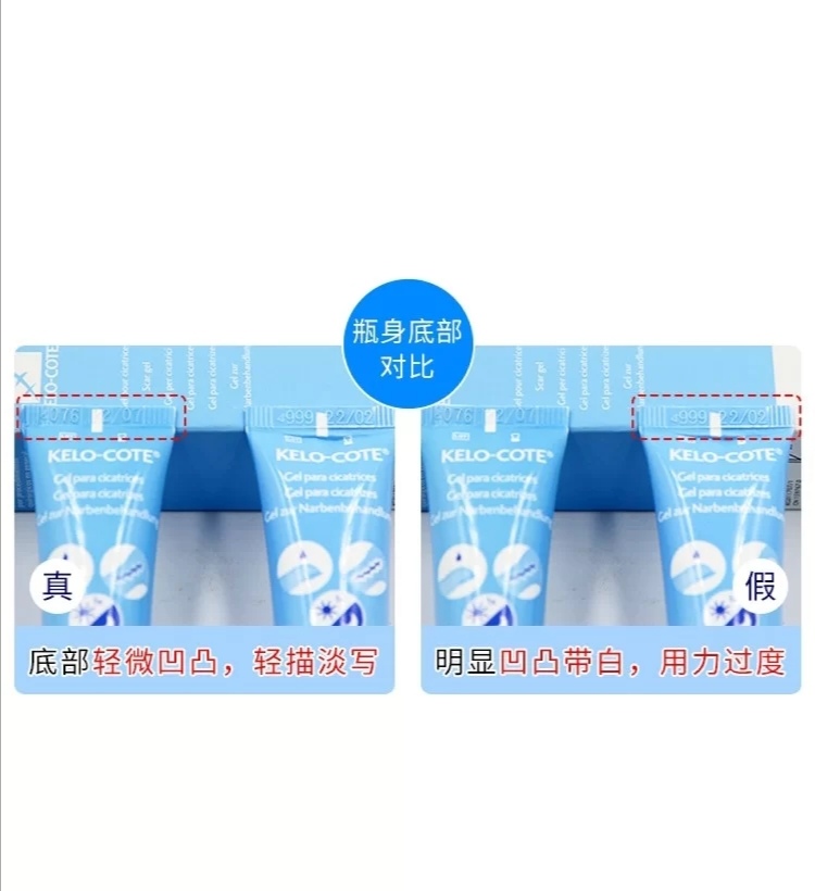 你用过最好的祛疤方法,超好用的祛疤产品