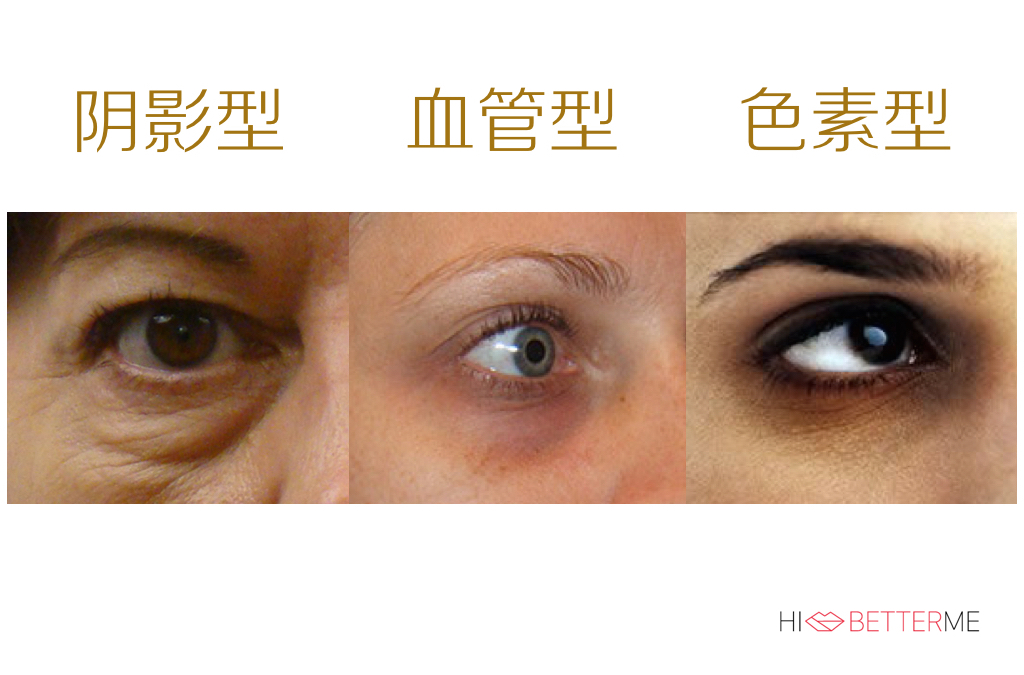 医学博士说眼霜真的治疗黑眼圈吗,真正对黑眼圈有用的眼霜