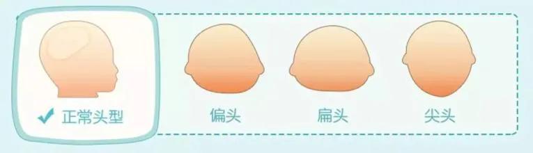 宝宝塑造头型的最佳时期,如何让刚出生的宝宝头型好看