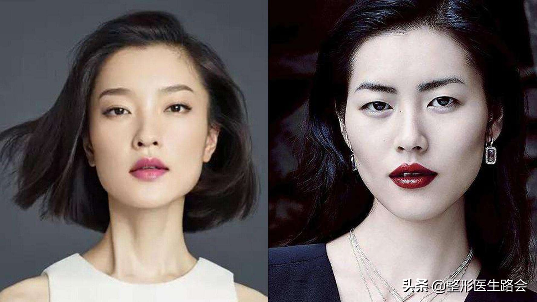 高颧骨苹果肌复位,颧骨太高苹果肌太饱满做什么手术