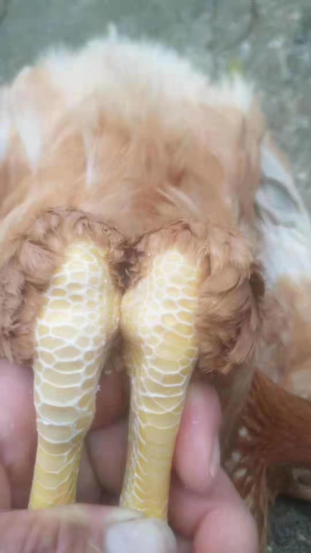 脚掌滑囊炎症状及治疗方法,脚踝滑膜囊积液怎么治疗