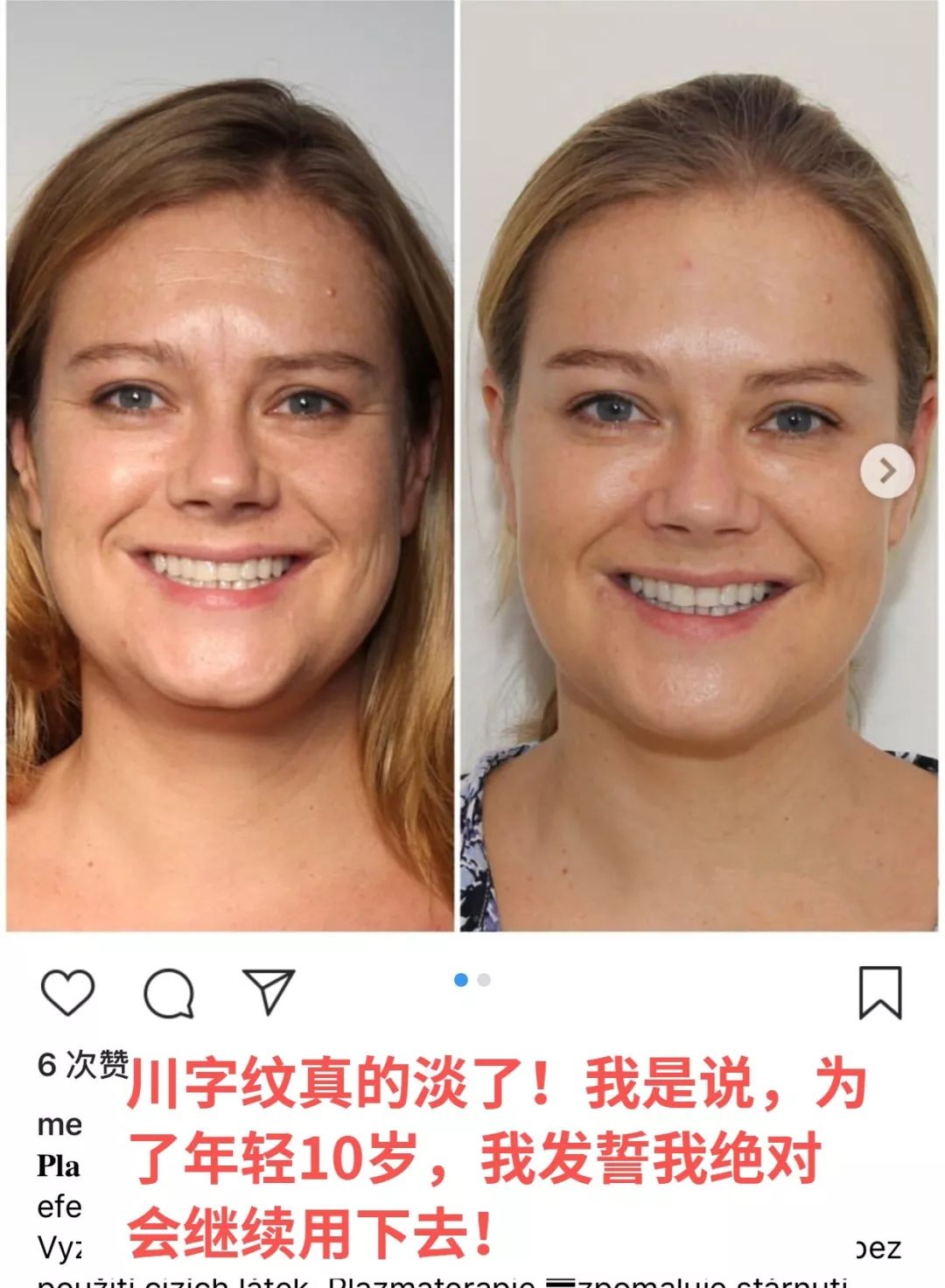 广末凉子年轻时短发,18岁的广末凉子图片