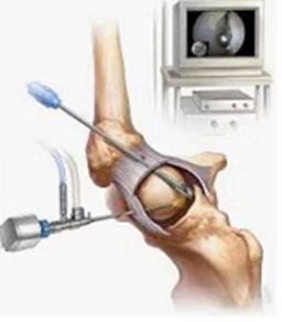 医学基础知识关节学,关节镜前世今生