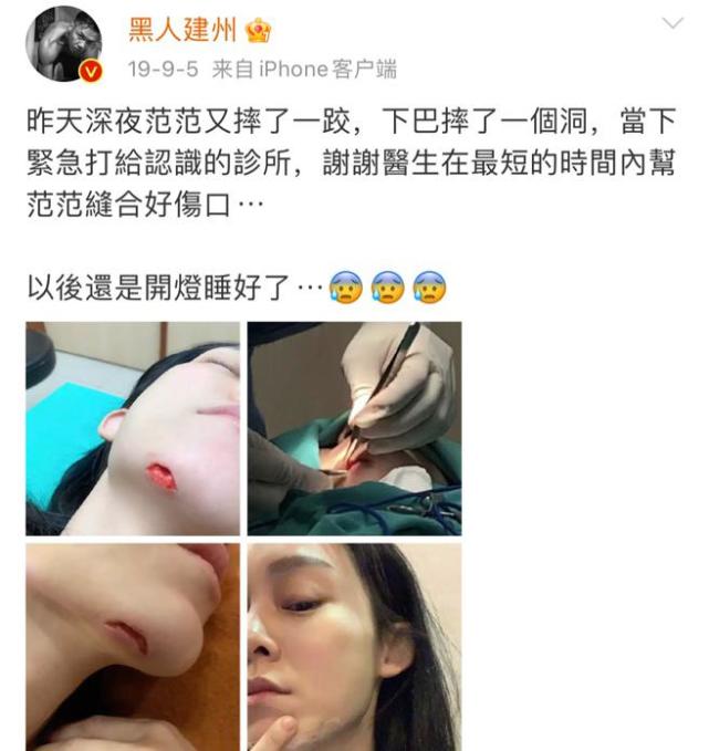 范玮琪不被喜欢的原因,范玮琪说没有伤害过任何人