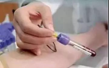 医生要求空腹抽血喝了水会怎么样,抽血为什么要空腹还不能喝水