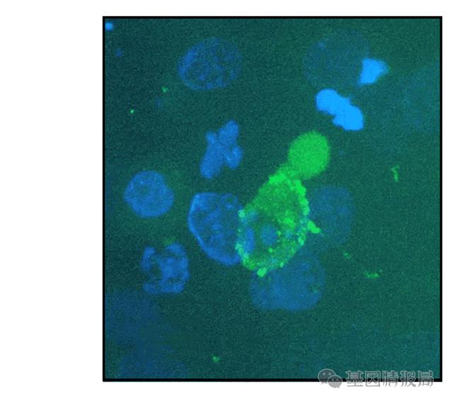 艾滋病病毒入侵全过程曝光,世界上被证实的艾滋病毒体外感染