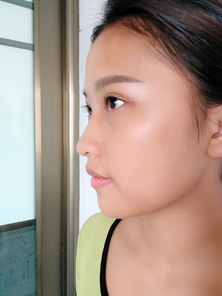 韩美做双眼皮,南昌韩美医院做双眼皮怎么样