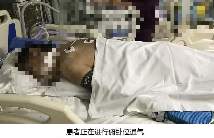 抢救心脏骤停死亡,抢救心脏骤停无效死亡